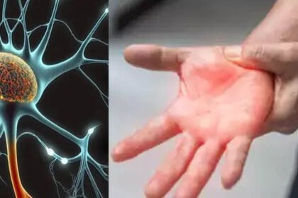 హైదరాబాద్లో జీబీఎస్ ... తొలి కేసు నమోదు కేసు