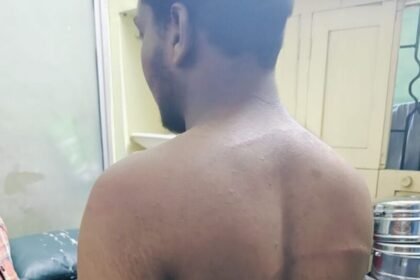 వారంగల్ నేరం: అమ్మాయికి అమ్మాయికి ఉద్యోగం దారుణం దారుణం, వరంగల్ వరంగల్ లో యువకుడిపై కర్రలు, బెల్టుతో బెల్టుతో బెల్టుతో