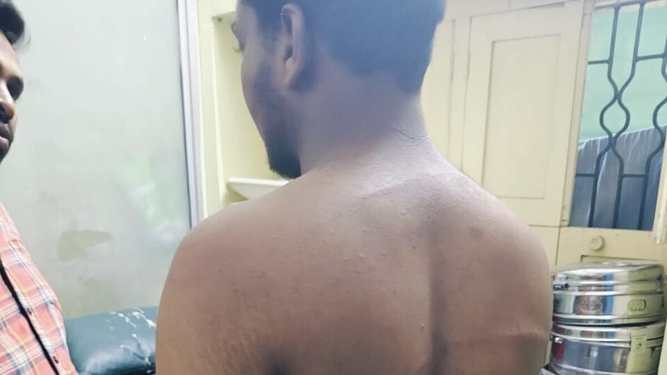 వారంగల్ నేరం: అమ్మాయికి అమ్మాయికి ఉద్యోగం దారుణం దారుణం, వరంగల్ వరంగల్ లో యువకుడిపై కర్రలు, బెల్టుతో బెల్టుతో బెల్టుతో