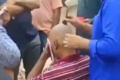 హైదరాబాద్: ఒత్తు జుట్టు కోసం కోసం వెళ్తే .. ఉన్న వెంట్రుకలు వెంట్రుకలు ఊడిపోయాయి .. హైదరాబాద్‌లో హైదరాబాద్‌లో ఘరానా!